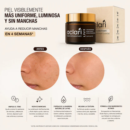 Aclari | Crema Despigmentante |